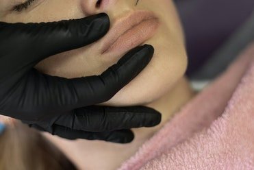 DERMAL FILLERS