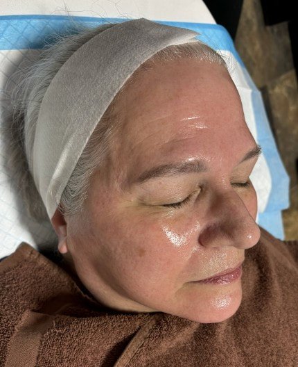 Dermaplaning Pleasant View UT
