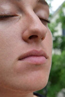 Facial laser hair removal