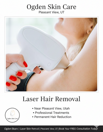 long term hair removal pleasant view utah