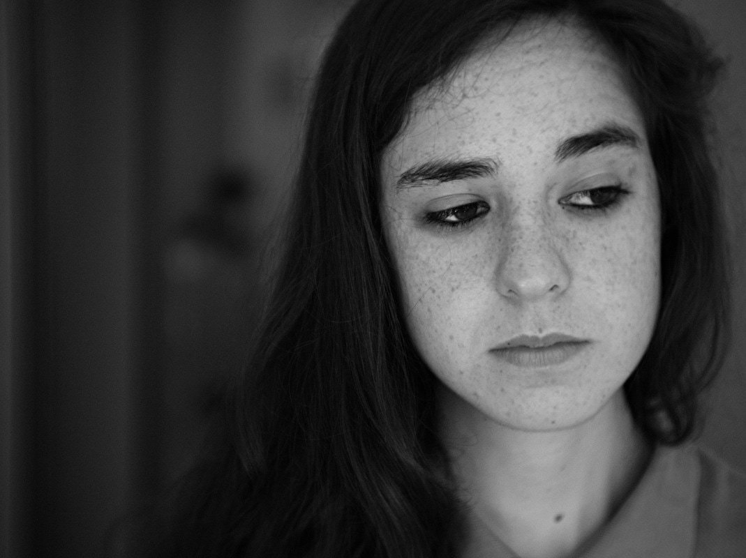 skin pigmentation blotches freckles orig