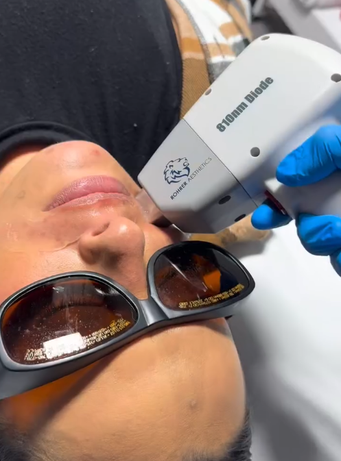 Laser Hair Removal Near Me Pleasant View – Safe & Effective