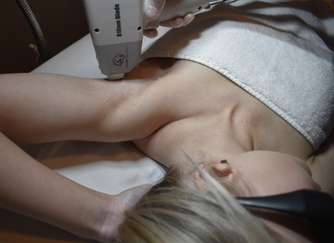 laser underarm hair removal Pleasant View