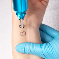 tattoo removal Ogden UT, laser tattoo removal Utah, tattoo fading Ogden, remove tattoo near me