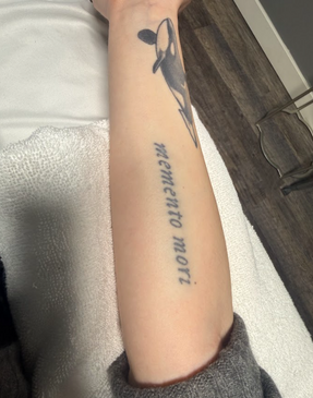 Tattoo removal Pleasant View Utah